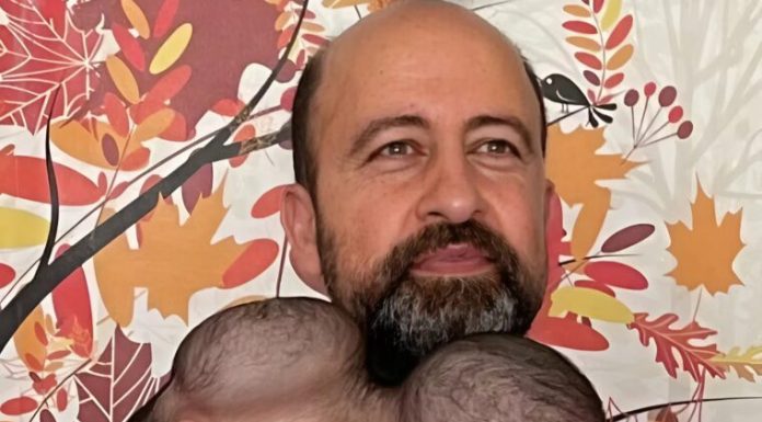 Od jedne glave do dva odvojena života: nevjerovatna operacija koja je promijenila sudbinu sestara Manal i Mirhi Od jedne glave do dva odvojena života: nevjerovatna operacija koja je promijenila sudbinu sestara Manal i Mirhi - featured image