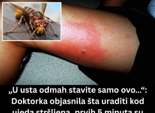 „U usta odmah stavite samo ovo…“: Doktorka objasnila šta uraditi kod ujeda stršljena, prvih 5 minuta su ključni